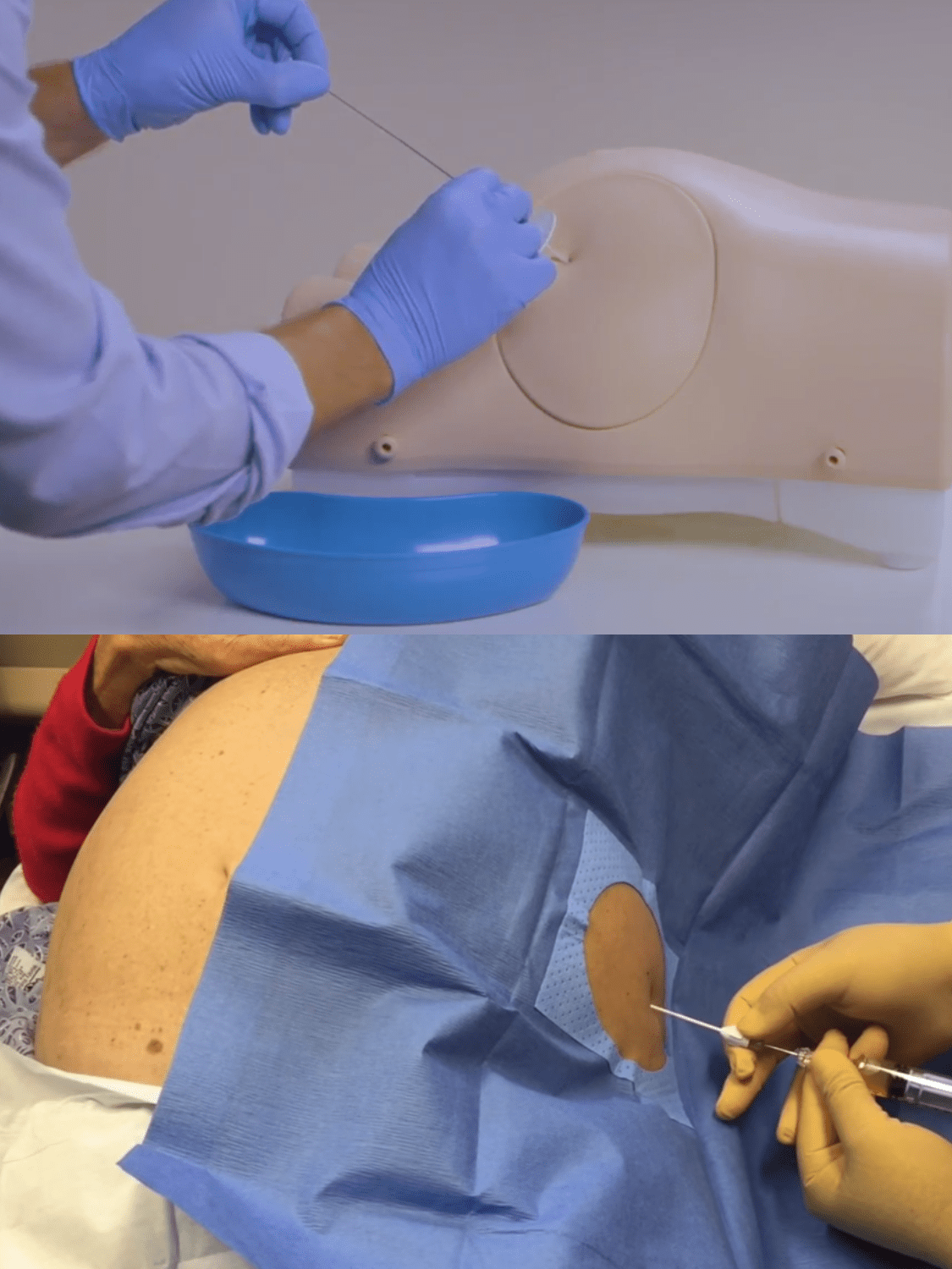 limbs&things cathinsertion